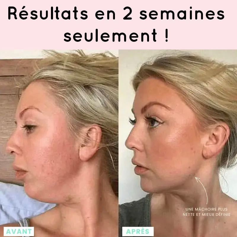 appareil LED anti-rides visage Alunéa Lift Pro