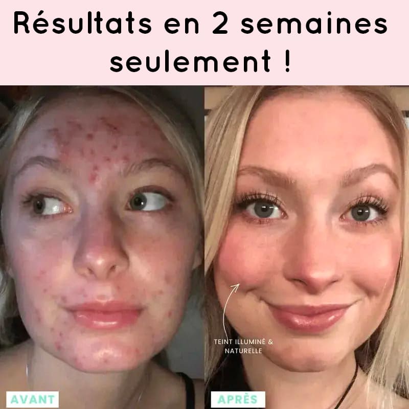 appareil LED anti-rides visage Alunéa Lift Pro