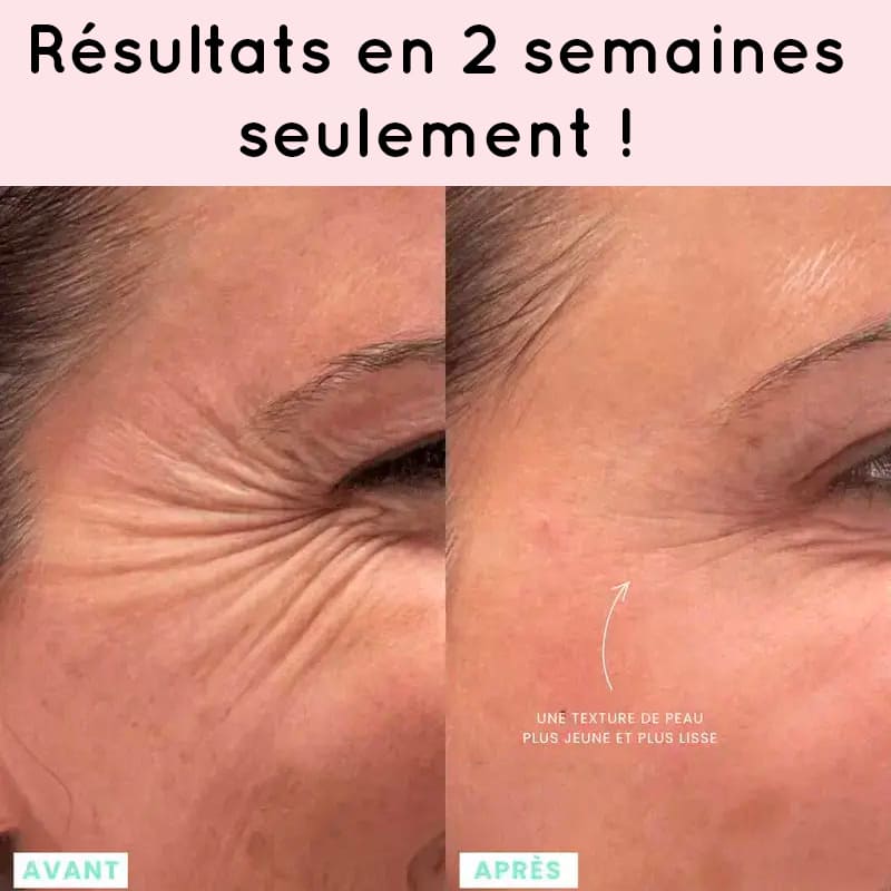 appareil LED anti-rides visage Alunéa Lift Pro