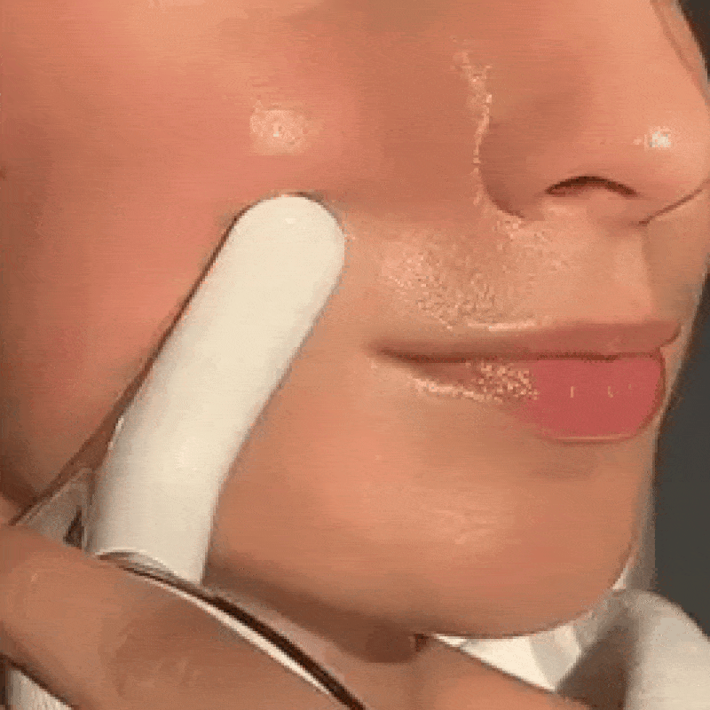 appareil LED anti-rides visage Alunéa Lift Pro